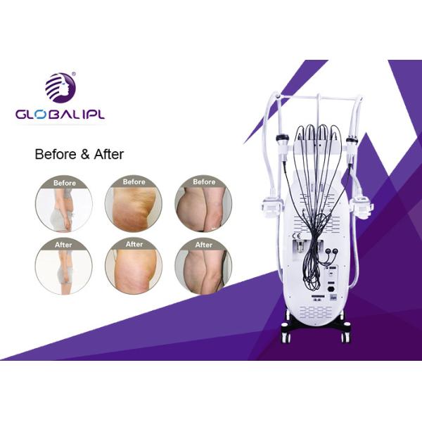 RF Fat Dissolving Cryolipolysis Machine 8.4 Inch Touch Screen Display CE Assured