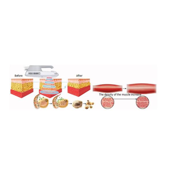 Skin Tightening Inner Ball Roller Machine