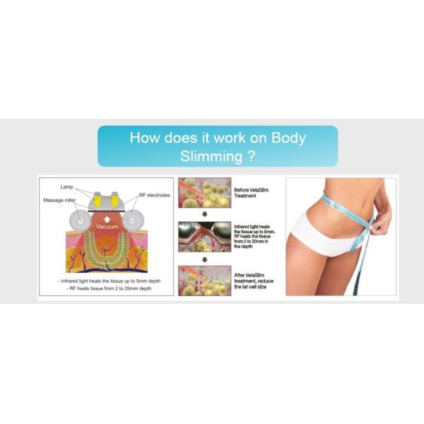 Cavitation+Vacuum+RF+Laser+Roller System Slimming non invasive liposuction machine CE