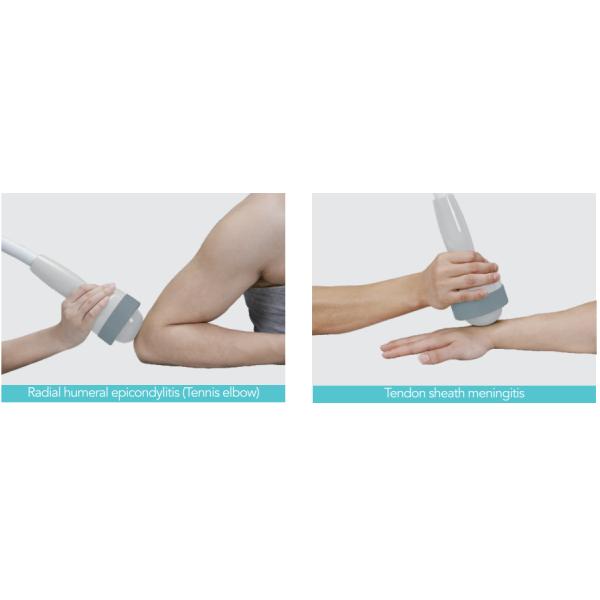 Professional Electromagnetic Extracorporeal Shockwave Therapy Machine for hospital use