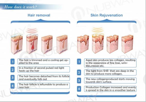 3 Working Principle of Super SHR IPL Laser hair removal.jpg