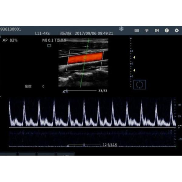 Color Doppler Ultrasound Probe Handheld Ultrasound Device For Mobilephone / PC