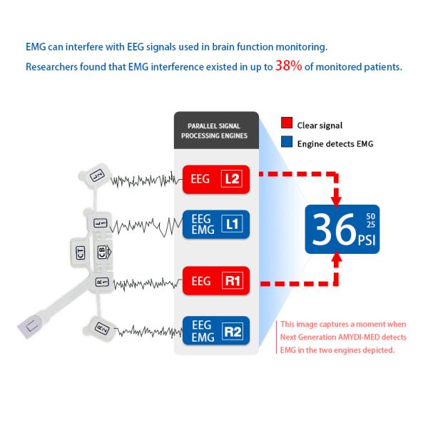 Disposable Eeg Brain Wave Sensor Non Invasive With Masimo 6 Electrodes