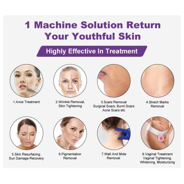 New Heave Hammer Vertical Model Vaginal Skin Resurfacing Therapy System For 7joints Guide Arm Folds Skin Whitening