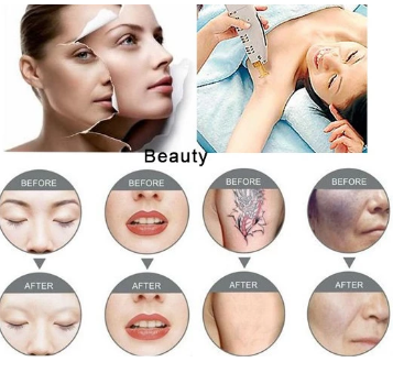 Medical Nd Yag Laser Tattoo Removal Machine Rod Yellow Pink Crystal 5*85mm