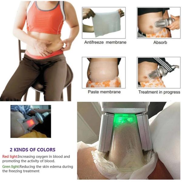 Portable 80KPa 8" Screen Cryo Slimming Machine