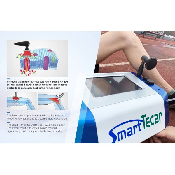 Mini Smart High Frequency 450KHz RF Beauty Equipment