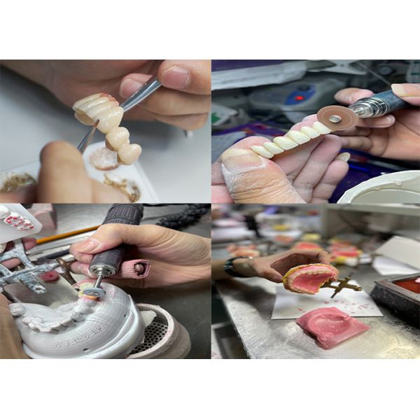Translucency Natural Esthetics Solid Zirconia Crown For Teeth Chipping Resistant