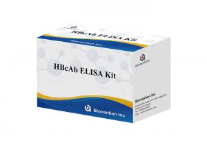 China HBcAb Blood Test Elisa Test Enzyme Linked Immunosorbent Assay on sale