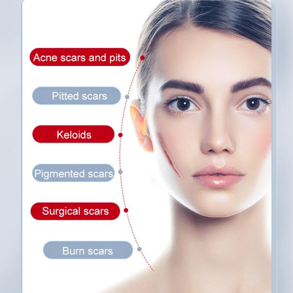 Scar repair cream, medical-grade silicone gel formula, reduces scarring.