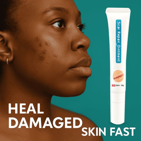 Scar Repair Cream - Effectively removes new and old scars, surgical scars, post-cesarean section scars, burn scars, scald scars, and pathological