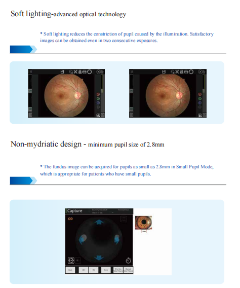 Retinal Non Mydriatic Fundus Camera 120GB Soft Lighting Optical Technology
