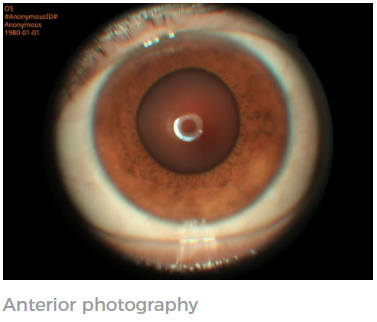 Non Mydriatic Automatic Fundus Camera Retinal Fundus Camera Imaging Red Free