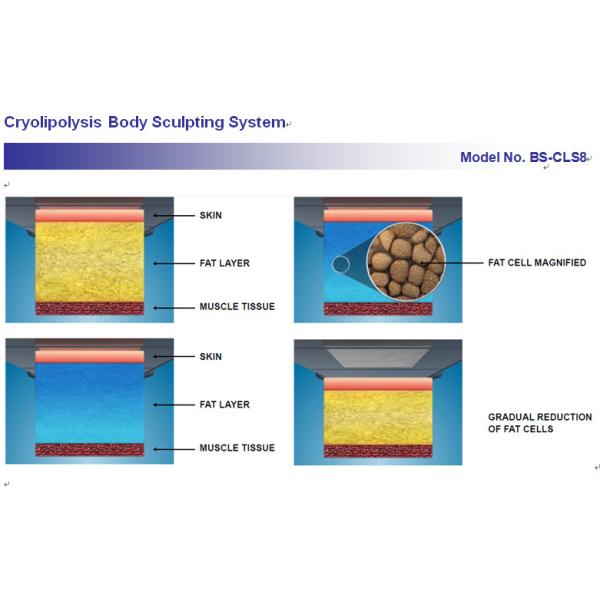 Cryolipolysis Fat Freeze Slimming Machine