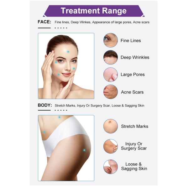 Skin Tightening RF Microneedling Machine