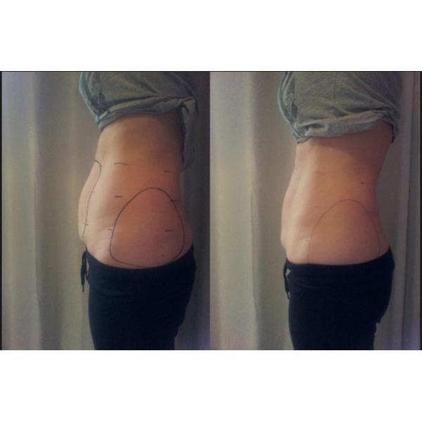 Multifunction Radio Frequency Fat Reduction Machine , Ultrasonic Vacuum Slimming Machine