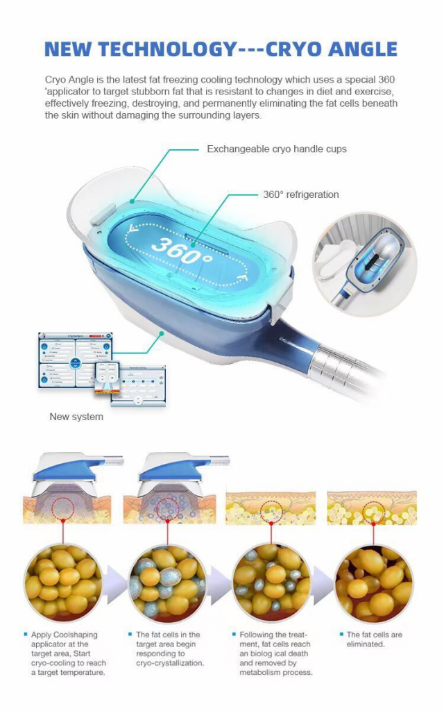 5 Handle 360 Cryo Cryotherapy body slimming machine