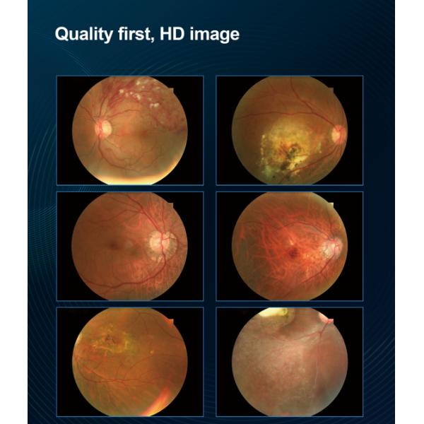 Non Mydriatic Fundus Camera with 2.8mm Minimum Pupil Size 35mm Operating Distance and ±25D Diopter Compensation