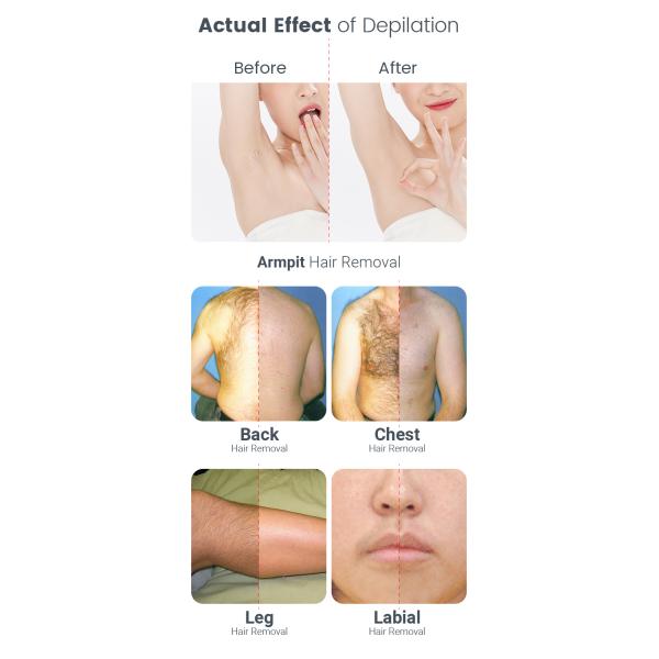 Mini Diode Laser Hair Removal Machine Custom With Strong Power