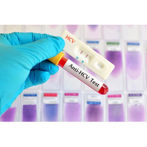 CE Qualitative Detection 35uL Whole Blood Hepatitis Rapid Test Kit