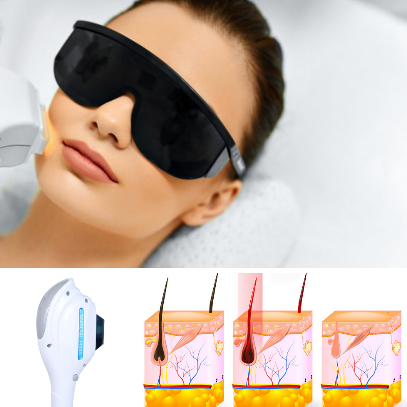 SHR hair removal machine