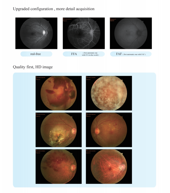 Accurate Autofocus Automatic Fundus Camera 60 Mm With Intelligent