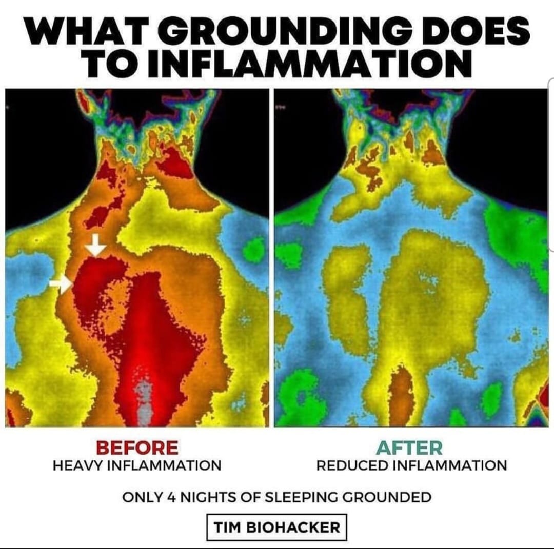 Grounding Conductive Bed Sheets for Better Sleep Earth Connected Bedding Grounding Fitted Sheet with Cord inside