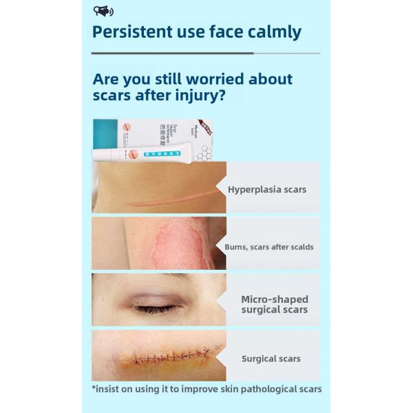 Repairable Abrasion Scar Removal Cream Repairable Laceration Scar Treatment Cream