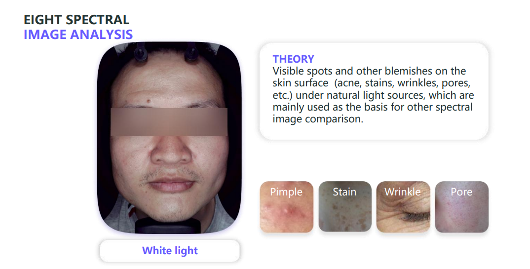 A6 2024 New AI 3D Face Analysis Beauty Analysis Pigmentation Detection Machine Skin Camera Digital Magic Mirror